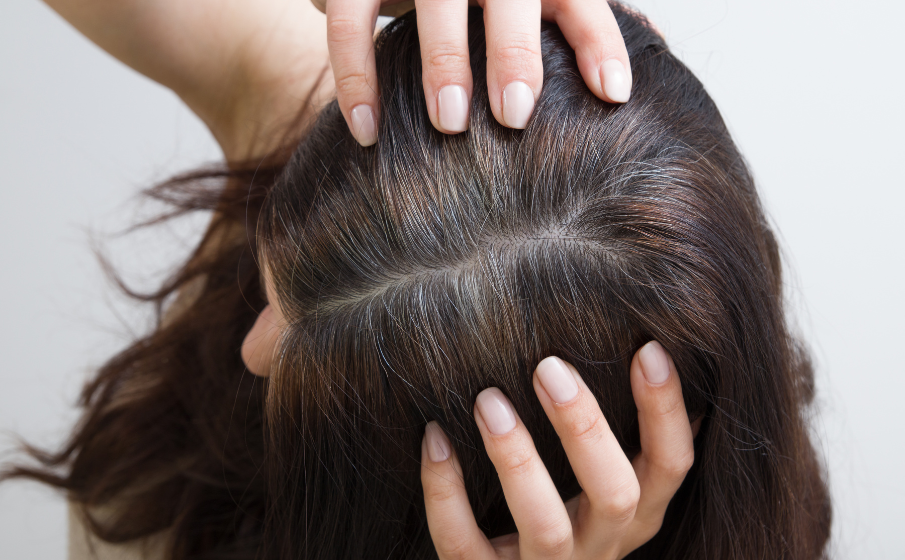 Zakola u kobiet || jak je zmniejszyć? Czy wcierki działają?