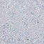 y-1009 || inny kolor